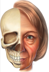 superomedial and inferolateral orbital rim, anterior maxilla, anterior maxilla, mandible